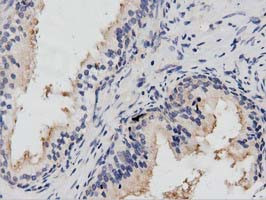 PTPRE Antibody in Immunohistochemistry (Paraffin) (IHC (P))