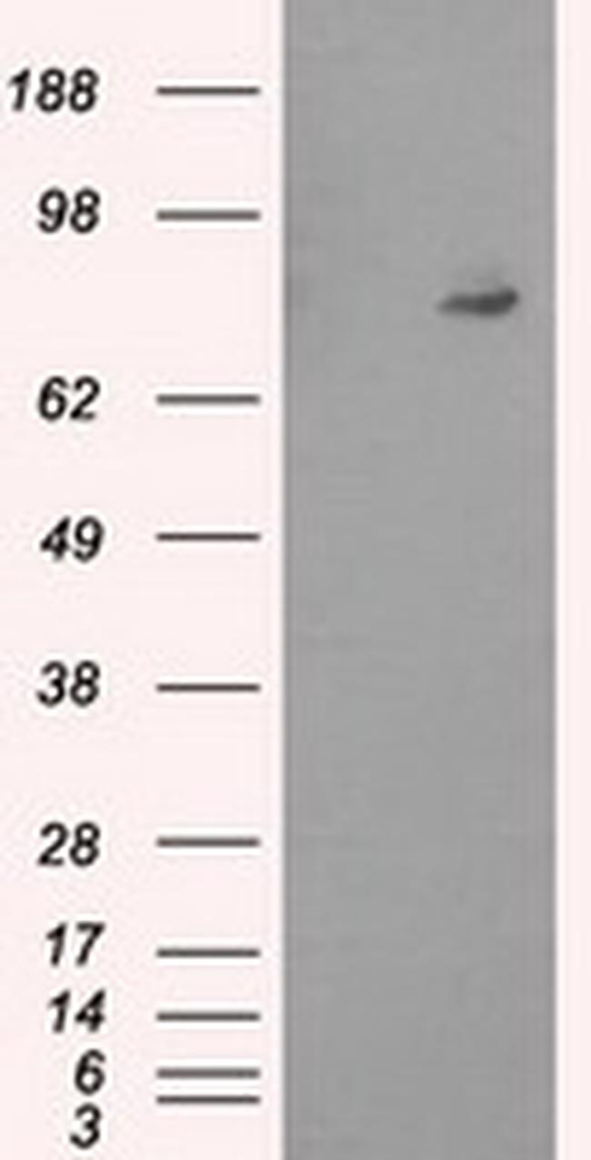 PTPRE Antibody in Western Blot (WB)