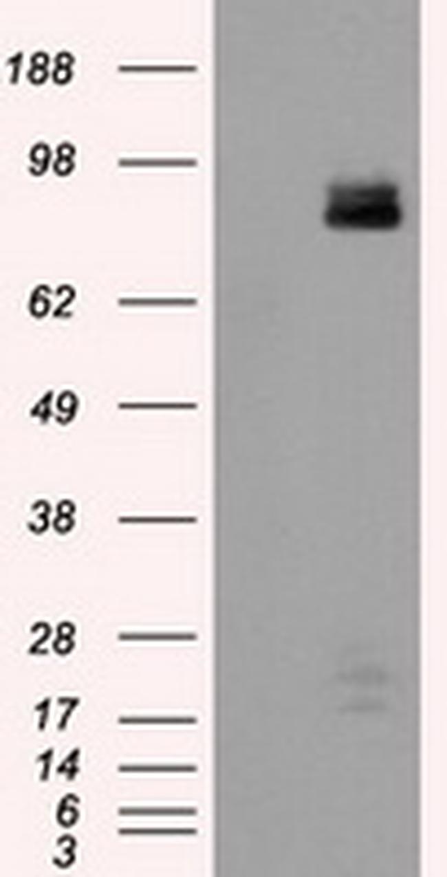 PTPRE Antibody in Western Blot (WB)