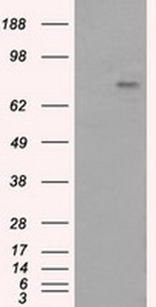 PTPRE Antibody in Western Blot (WB)