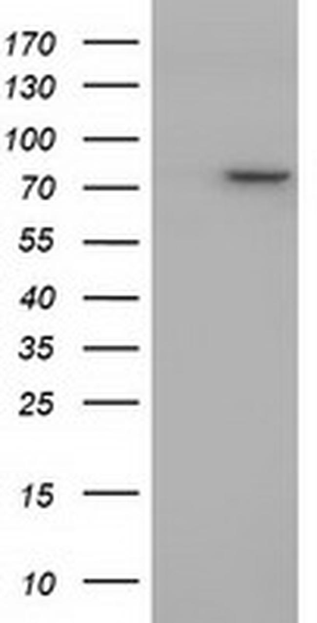 PTPRE Antibody in Western Blot (WB)