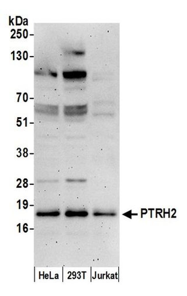 PTRH2/BIT1 Antibody in Western Blot (WB)