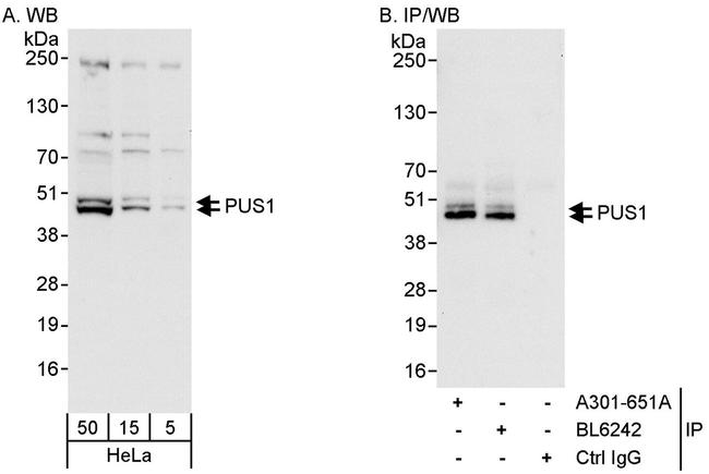 PUS1 Antibody in Western Blot (WB)