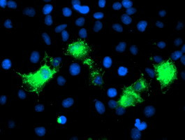 PVRL1 Antibody in Immunocytochemistry (ICC/IF)