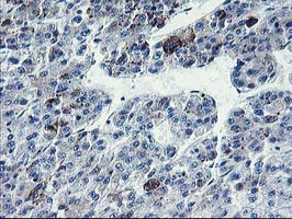 PVRL1 Antibody in Immunohistochemistry (Paraffin) (IHC (P))