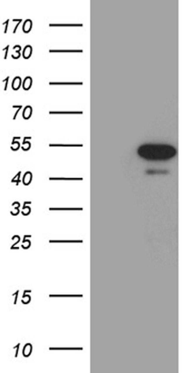 PXN Antibody in Western Blot (WB)