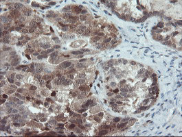 PYCARD Antibody in Immunohistochemistry (Paraffin) (IHC (P))