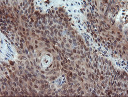 PYCARD Antibody in Immunohistochemistry (Paraffin) (IHC (P))