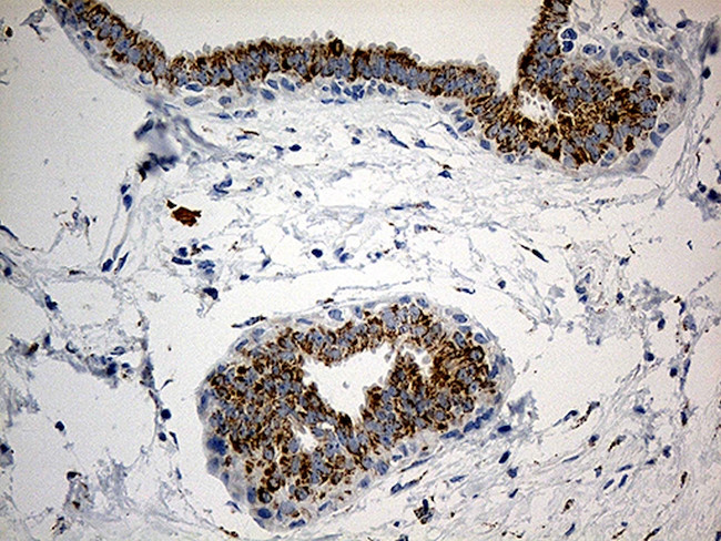 PYCR1 Antibody in Immunohistochemistry (Paraffin) (IHC (P))