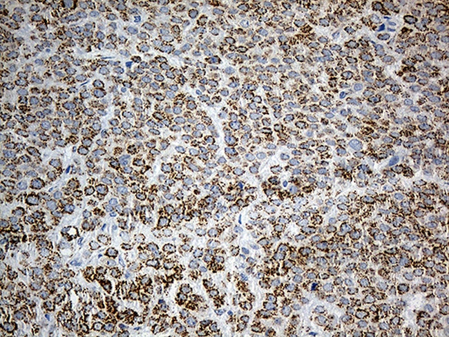 PYCR1 Antibody in Immunohistochemistry (Paraffin) (IHC (P))