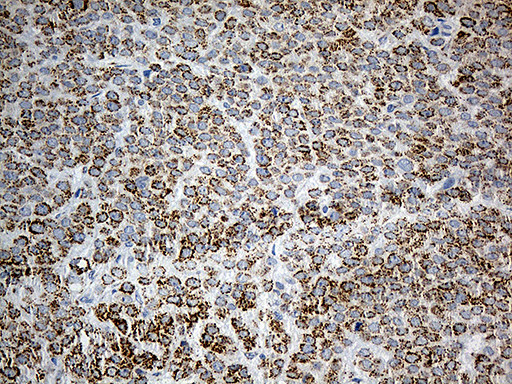 PYCR1 Antibody in Immunohistochemistry (Paraffin) (IHC (P))