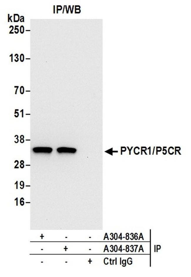 PYCR1/P5CR Antibody in Western Blot (WB)
