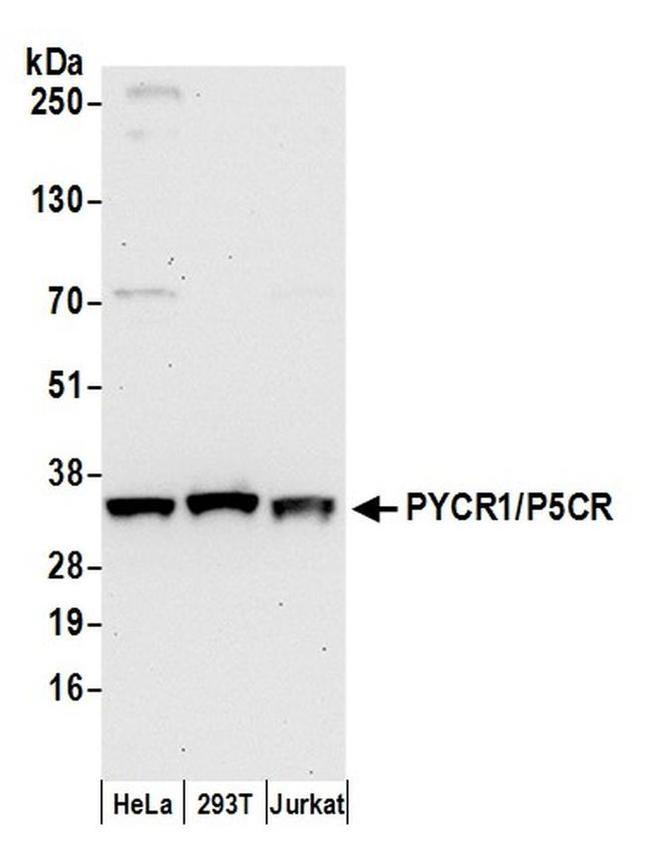PYCR1/P5CR Antibody in Western Blot (WB)