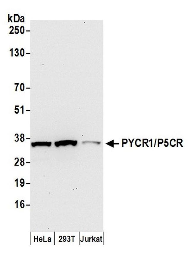 PYCR1/P5CR Antibody in Western Blot (WB)