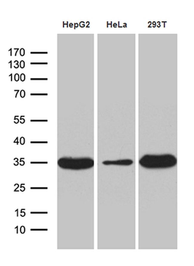 PYCR1 Antibody in Western Blot (WB)