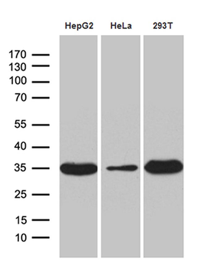 PYCR1 Antibody in Western Blot (WB)