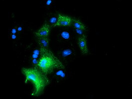 PYCR2 Antibody in Immunocytochemistry (ICC/IF)