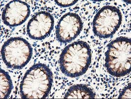 PYCR2 Antibody in Immunohistochemistry (Paraffin) (IHC (P))