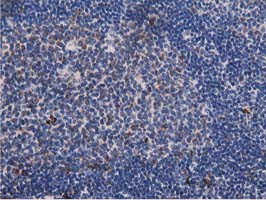 PYCR2 Antibody in Immunohistochemistry (Paraffin) (IHC (P))