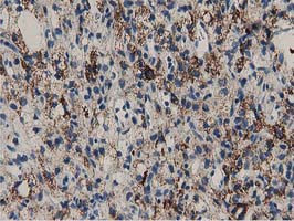 PYCR2 Antibody in Immunohistochemistry (Paraffin) (IHC (P))