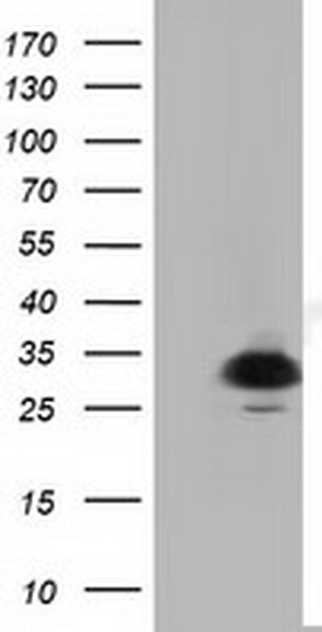 PYCR2 Antibody in Western Blot (WB)