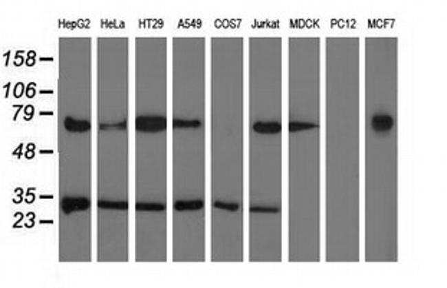 PYCR2 Antibody in Western Blot (WB)