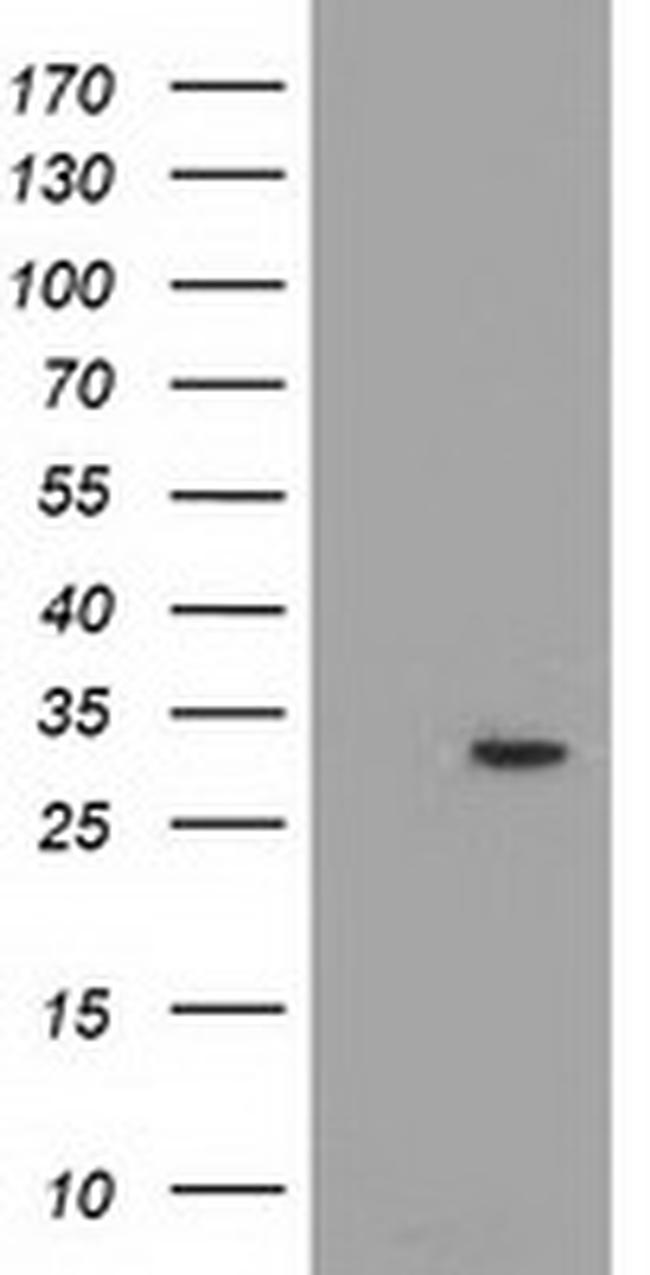 PYCR2 Antibody in Western Blot (WB)