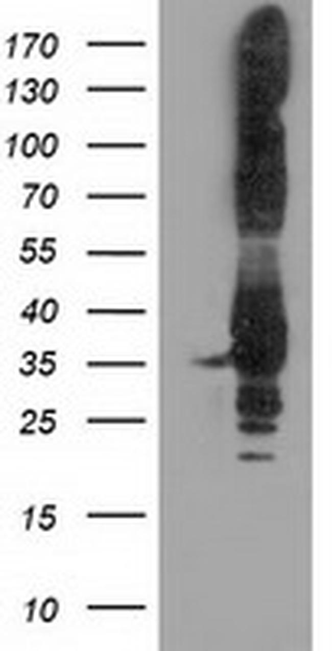 PYCR2 Antibody in Western Blot (WB)