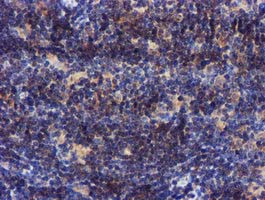 PYCRL Antibody in Immunohistochemistry (Paraffin) (IHC (P))