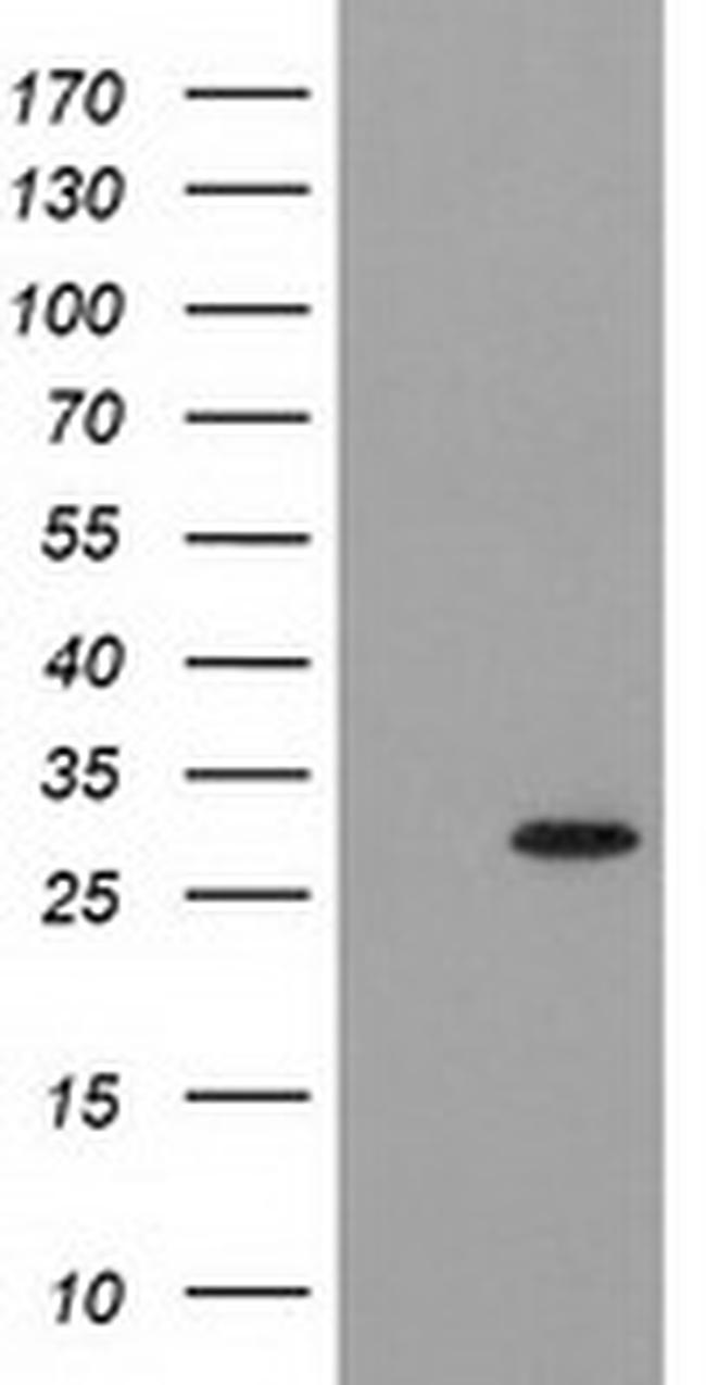 PYCRL Antibody in Western Blot (WB)