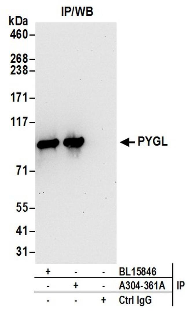 PYGL Antibody in Western Blot (WB)