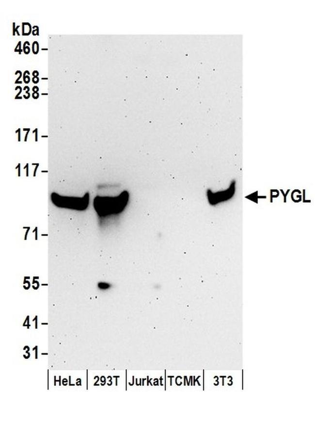 PYGL Antibody in Western Blot (WB)