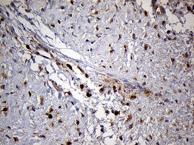 PYGM Antibody in Immunohistochemistry (Paraffin) (IHC (P))