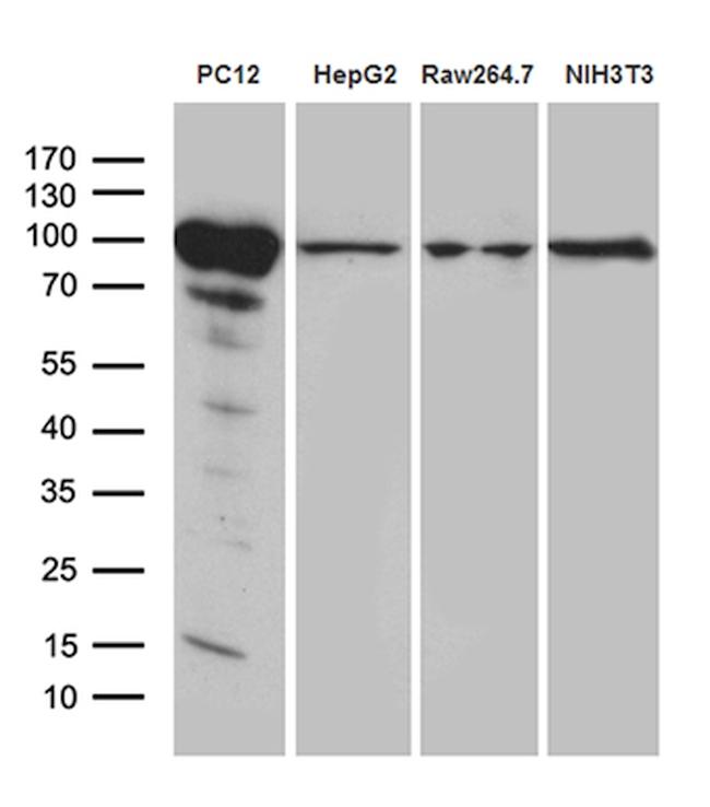 PYGM Antibody in Western Blot (WB)