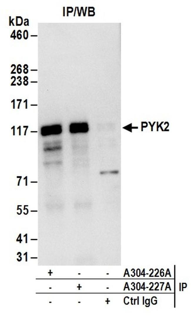 PYK2 Antibody in Western Blot (WB)