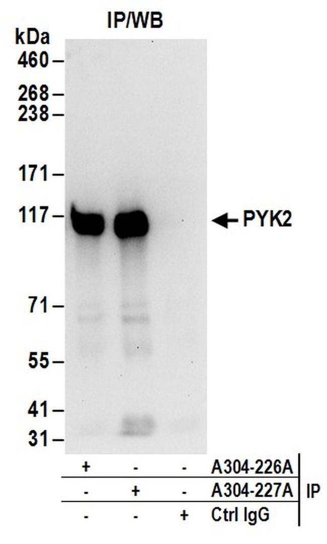 PYK2 Antibody in Western Blot (WB)