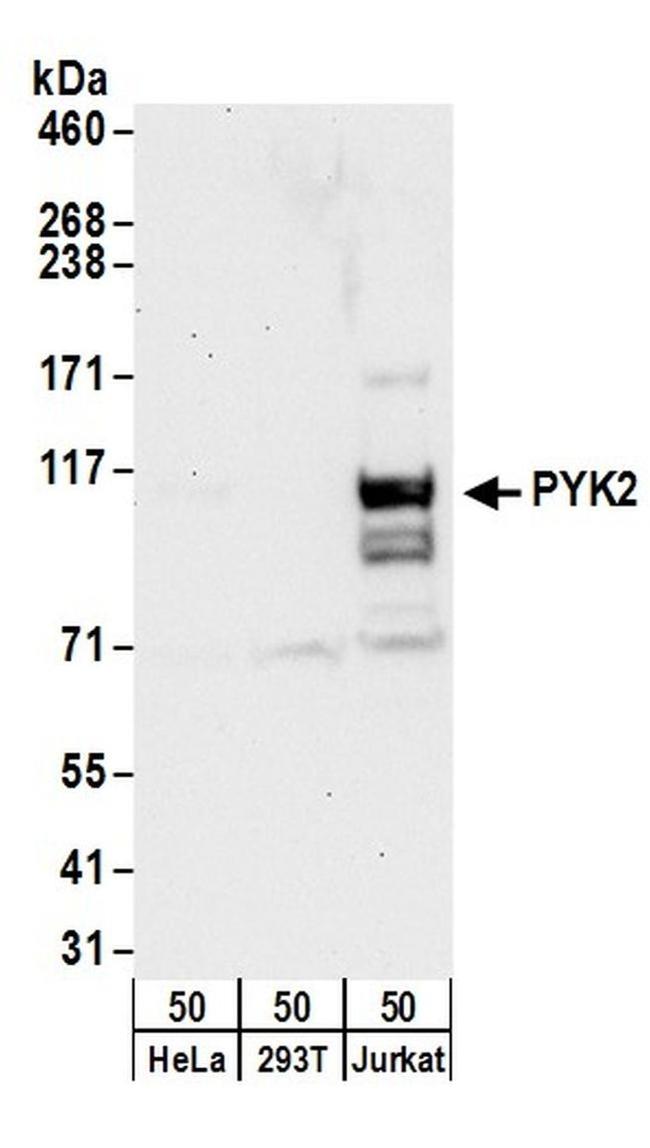 PYK2 Antibody in Western Blot (WB)