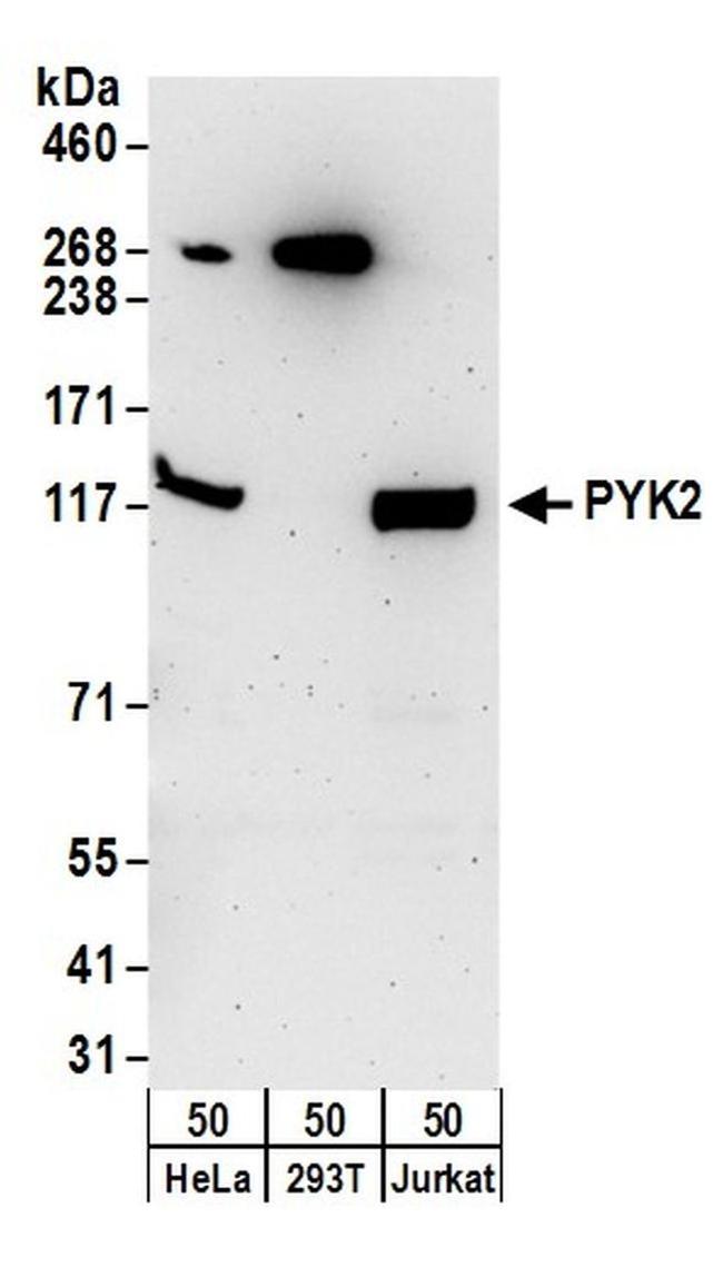 PYK2 Antibody in Western Blot (WB)