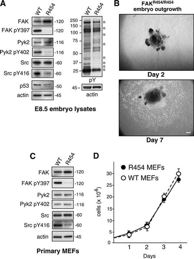 Phospho-PYK2 (Tyr402) Antibody in Western Blot (WB)