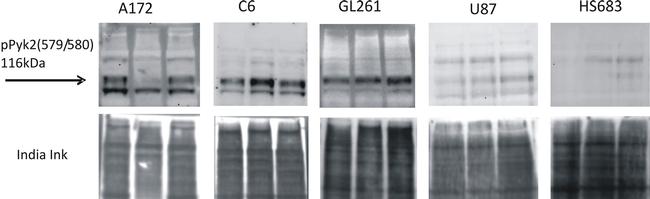 Phospho-PYK2 (Tyr579, Tyr580) Antibody in Western Blot (WB)