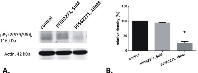 Phospho-PYK2 (Tyr579, Tyr580) Antibody in Western Blot (WB)