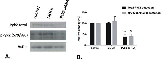 Phospho-PYK2 (Tyr579, Tyr580) Antibody in Western Blot (WB)