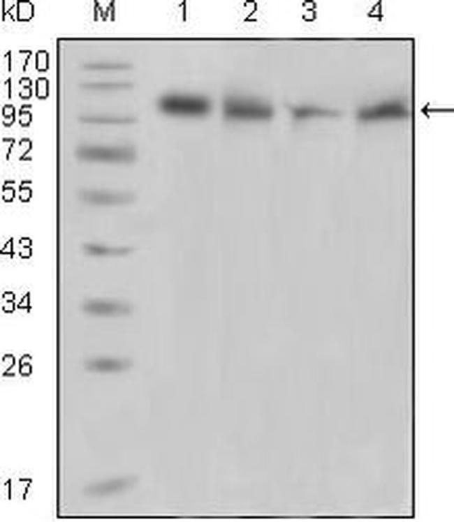 PYK2 Antibody in Western Blot (WB)