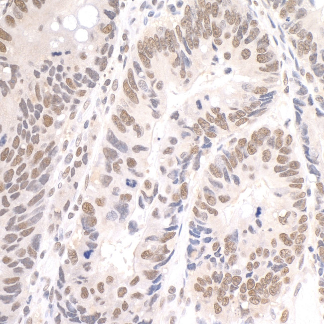 Paf1 Antibody in Immunohistochemistry (IHC)