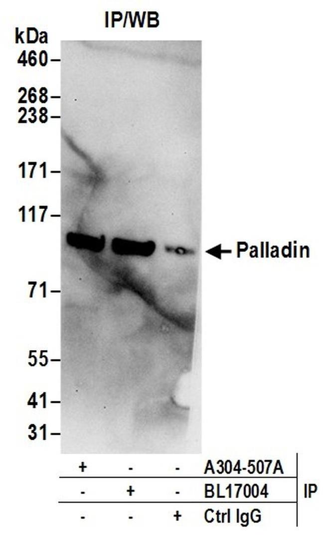 Palladin Antibody in Western Blot (WB)