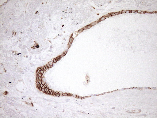 Pan-CDH Antibody in Immunohistochemistry (Paraffin) (IHC (P))