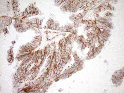 Pan-CDH Antibody in Immunohistochemistry (Paraffin) (IHC (P))