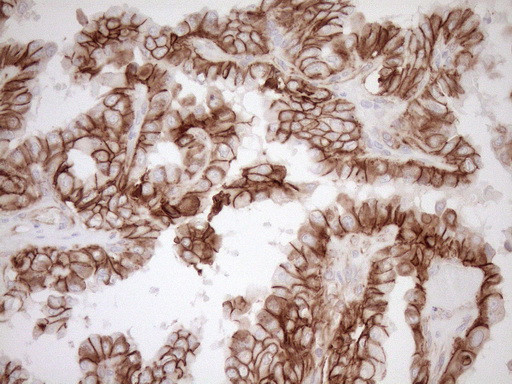 Pan-CDH Antibody in Immunohistochemistry (Paraffin) (IHC (P))