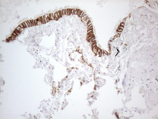 Pan-CDH Antibody in Immunohistochemistry (Paraffin) (IHC (P))