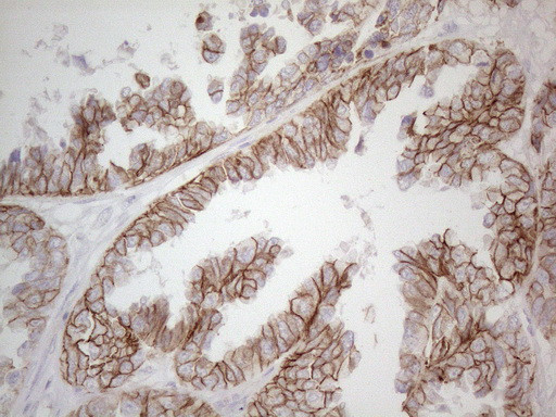 Pan-CDH Antibody in Immunohistochemistry (Paraffin) (IHC (P))